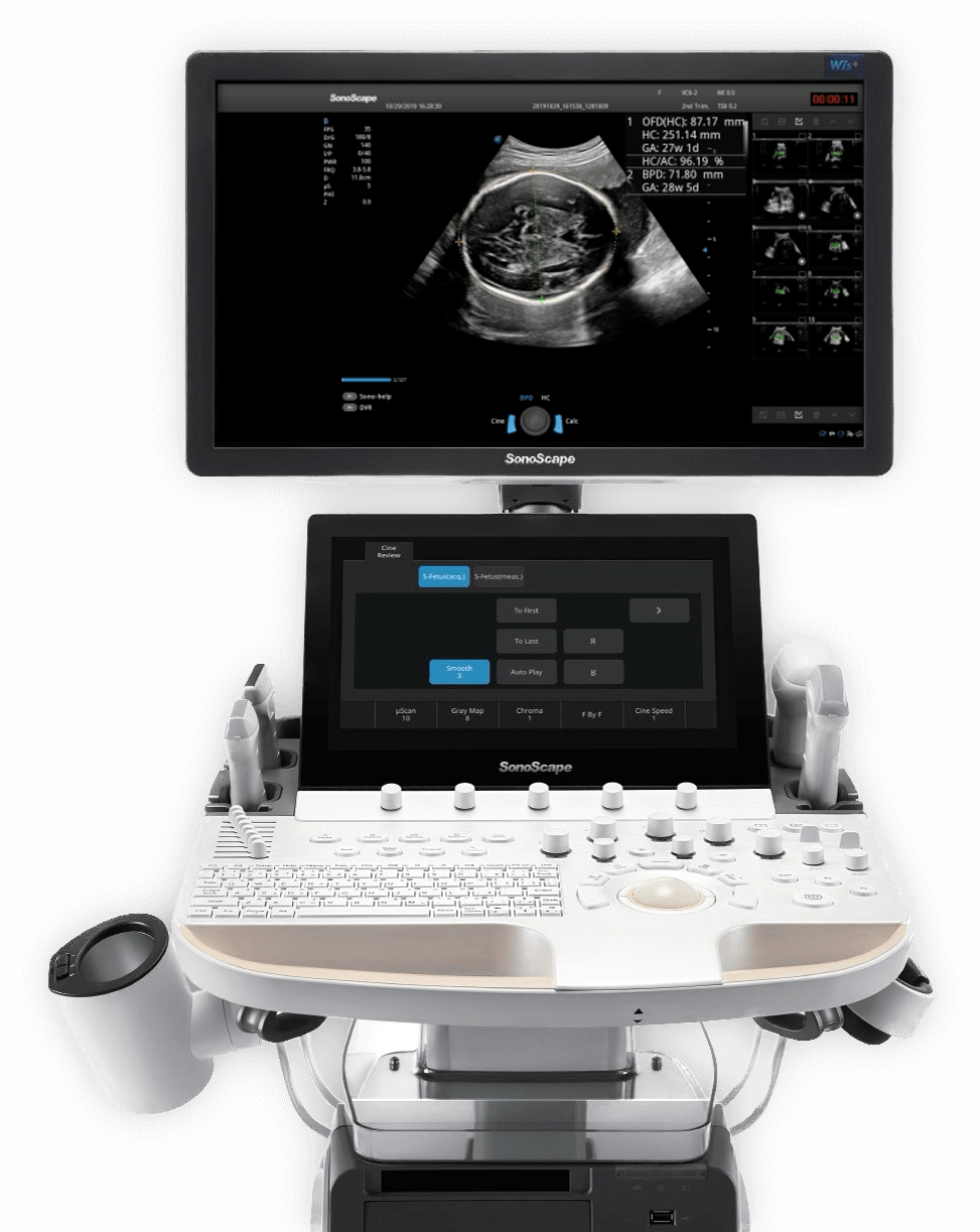 P60_Exp_03_S-Fetus